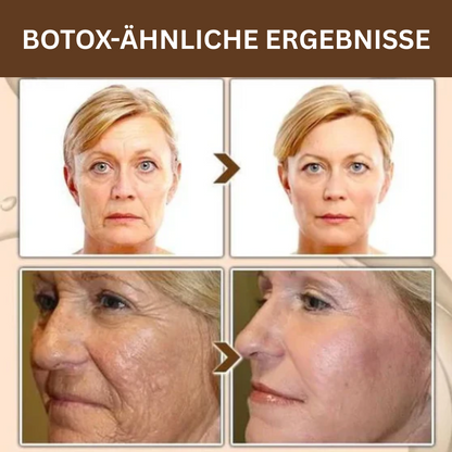 DermaLift™ Peptidcreme – Glatter & straffer in 14 Tagen