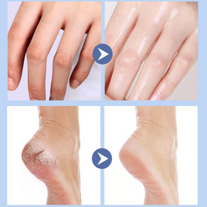Pedivell™ Fußbalsam – Glatte & Gepflegte Fersen