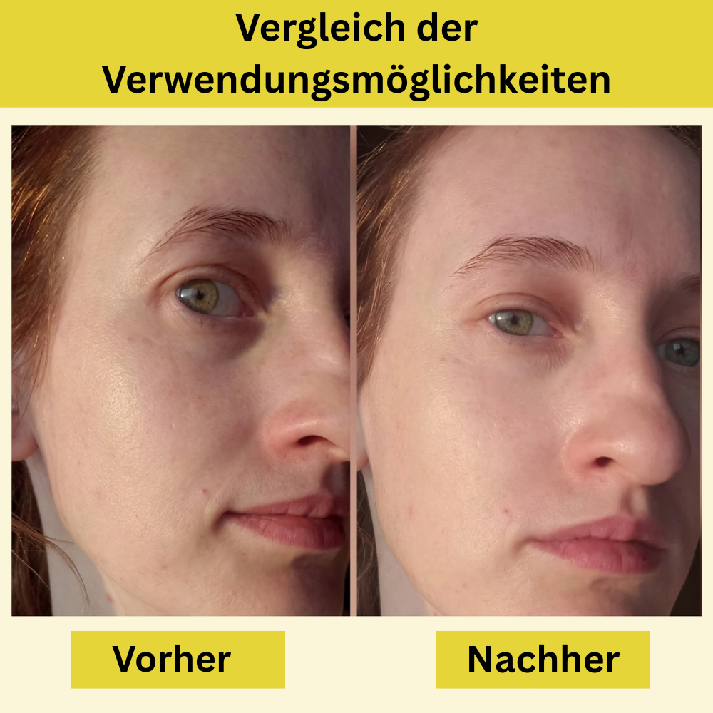 SkinMilch™ – Hydratisierende Gesichtsspray mit Hyaluronsäure & Squalan